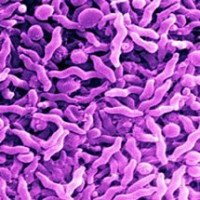 Campylobacter Food Poisoning