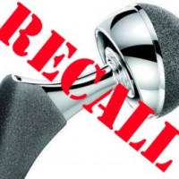 DePuy Hip Recall Lawsuit