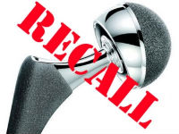 DePuy Hip Implant Lawsuit