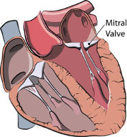 Mitral valve prolapse birth defects antidepressant drug injury lawyer lawsuit attorney class action litigation settlement claim
