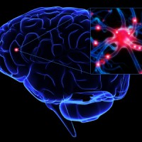 Traumatic-Brain-Injury