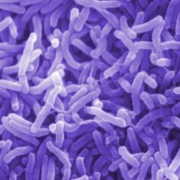 Cholera Food Poisoning