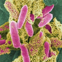 E. coli Food Poisoning