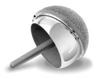 hip implant lawsuit