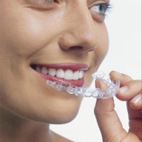 Invisalign Braces Lawsuit Lawyer