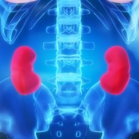 OsmoPrep Kidney Injury