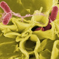 Salmonella Food Poisoning