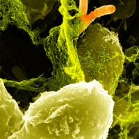 Shigella Food Poisoning
