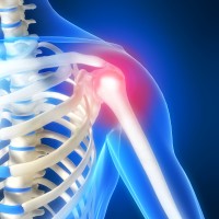 shoulder-pain-pump