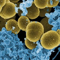 Staph Aureus Food Poisoning