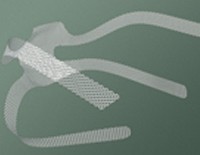 transvaginal-mesh
