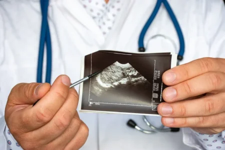 Atherectomy Amputation Lawsuit