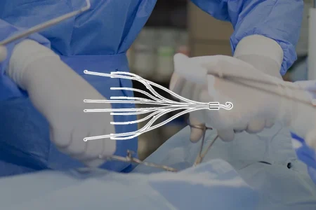 Bard IVC Filter and surgeons in the background
