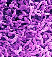 Campylobacter campylobacteriosis Food Poisoning Infection