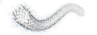 Cook Zilver PTX Stent Lawsuit