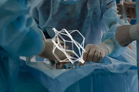 Surgeons performing an operation to place a Cordis IVC Filter