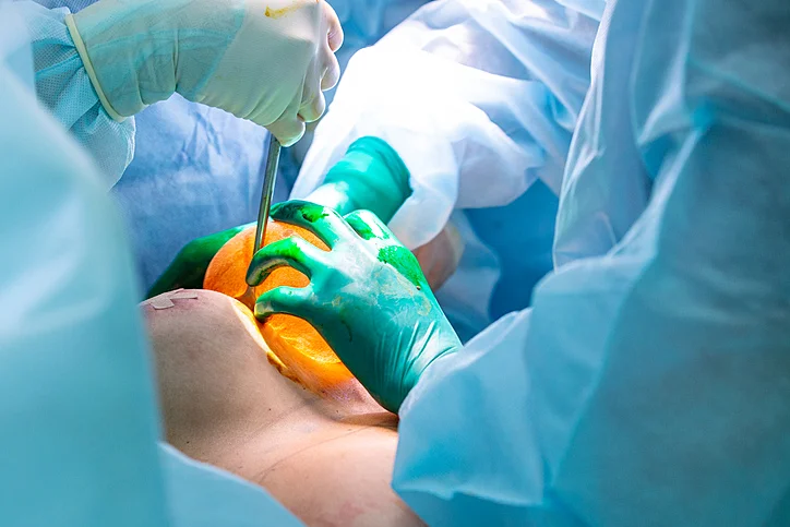 Ethicon Surgical