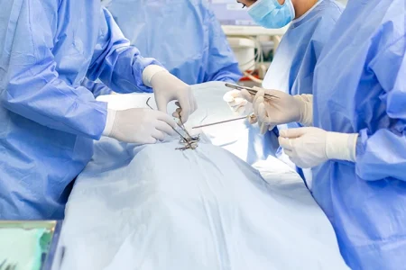doctors and nurses doing surgery with hernia mesh