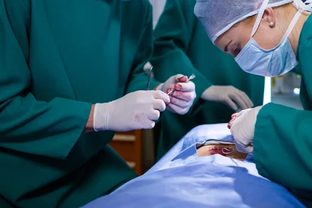 hernia mesh surgery relating for a lawsuit