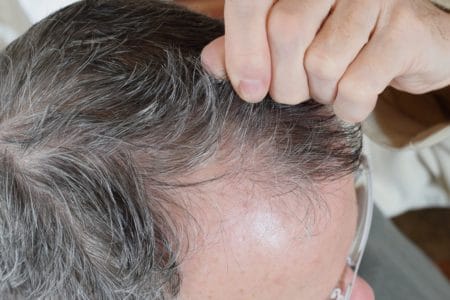 Hair Growth Serum Lawsuit