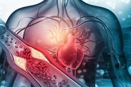 HawkOne Directional Atherectomy System Lawsuit