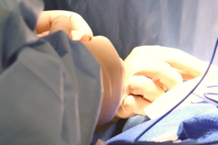Hernia Mesh Lawsuit Settlements – What to Expect and When Featured Image