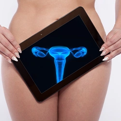Woman holding an ipad with a blueprint scan of reproductive organ