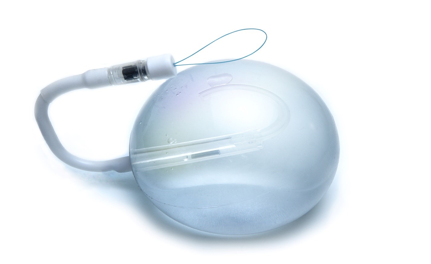 Intragastric Balloon