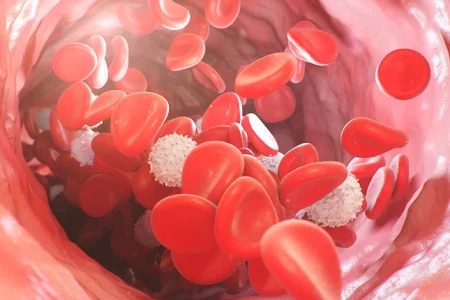 Blood cells with Myelofibrosis flowing in the veins