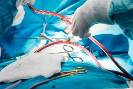 Doctors in a surgery related to North Carolina Impella heart pump lawsuit
