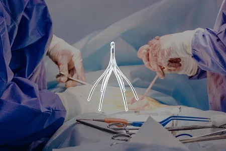 Option ELITE IVC Filter and a background of surgeons performing an operation