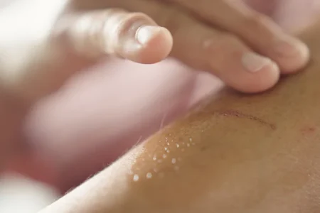Relieve Numbing Cream Recall Lawsuit
