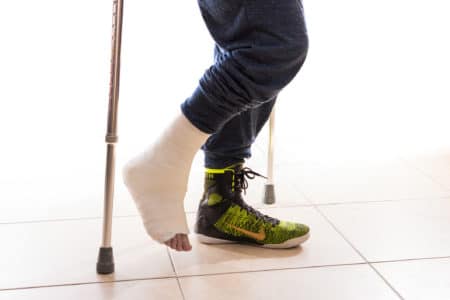 STAR Ankle Replacement Lawsuit