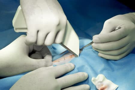 Surgical Stapler