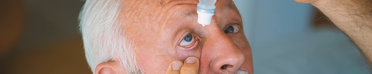 A cataract patient dropping medicine into his eyes