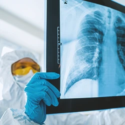 A doctor looking at the sternum x-ray of a patient