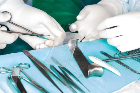 hernia mesh bowel obstruction lawsuit