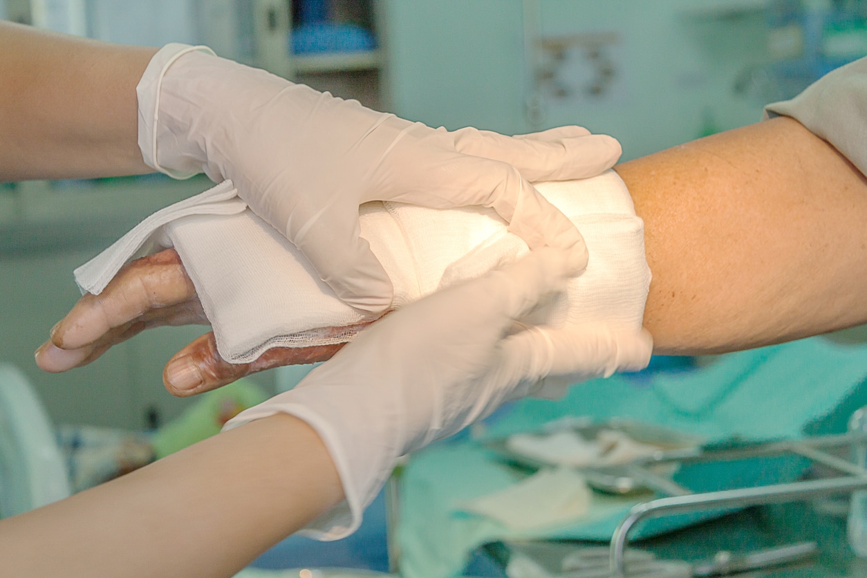 Pressure cooker burn injuries